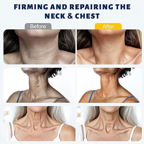 Roller Massage Neck Cream 🧴 Collagen & Hyaluronic Acid | Firms Neck, Reduces Wrinkles & Double Chin✨