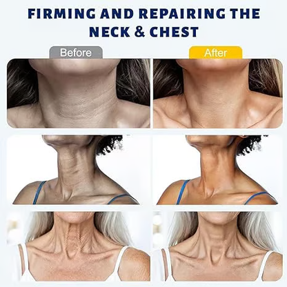 Roller Massage Neck Cream 🧴 Collagen & Hyaluronic Acid | Firms Neck, Reduces Wrinkles & Double Chin✨