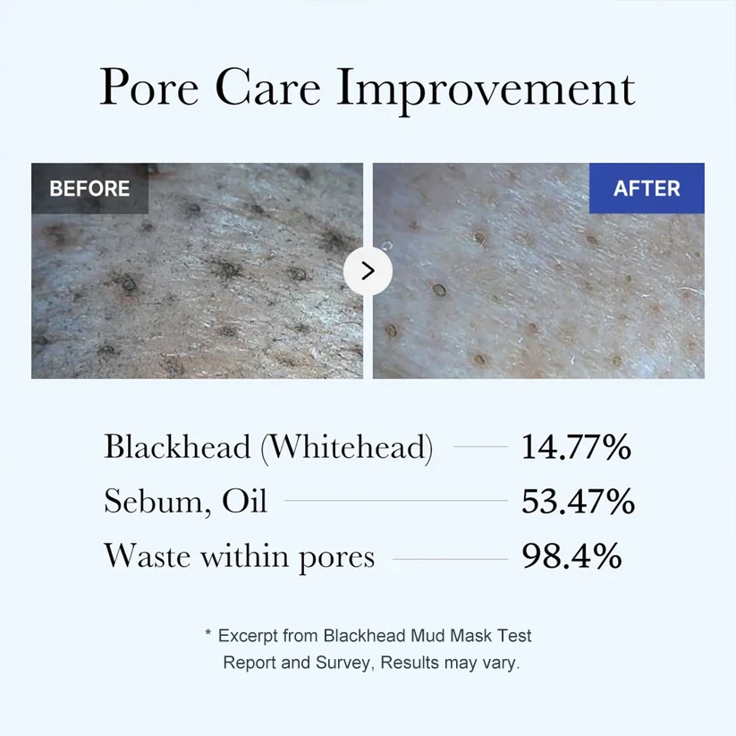 Zero Pores Blackhead Mud Mask-Free Pore Brush