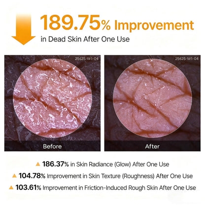 Tkhotpick Peel Shot - Kojic + Turmeric Body Peel Spray